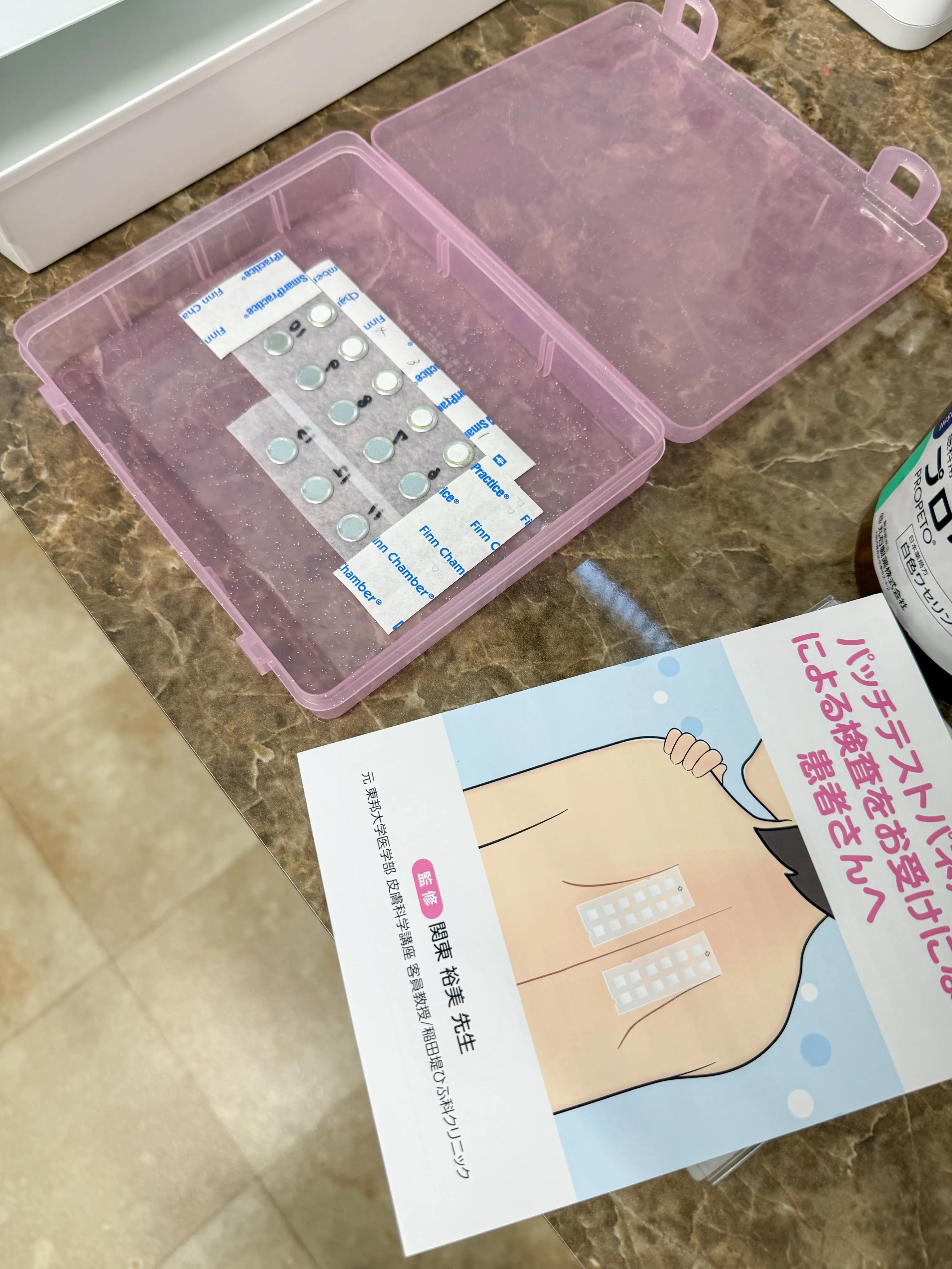 🩺アレルギー検査の準備中📋