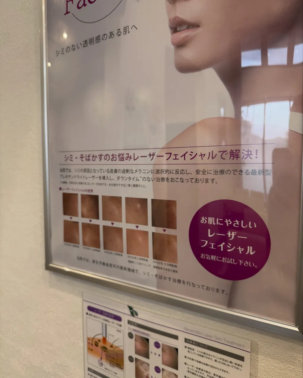 「レーザー治療ってどんなことをするの？」