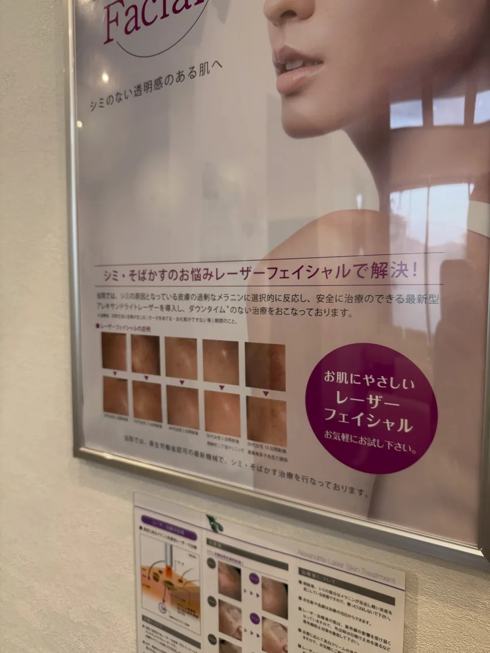📢 レーザー治療は平日午前中も受けていただけます🌸