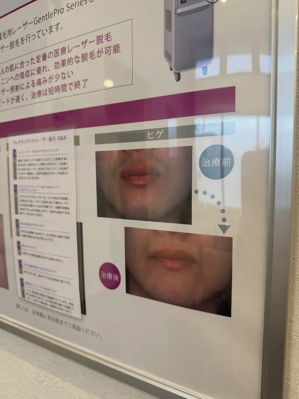 📢 レーザー治療は平日午前中も受けていただけます🌸